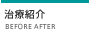 治療紹介